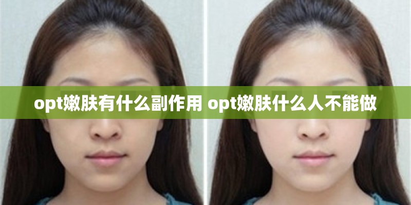 opt嫩肤有什么副作用 opt嫩肤什么人不能做